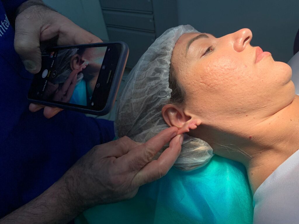 Você sabe o que é LOBULOPLASTIA?